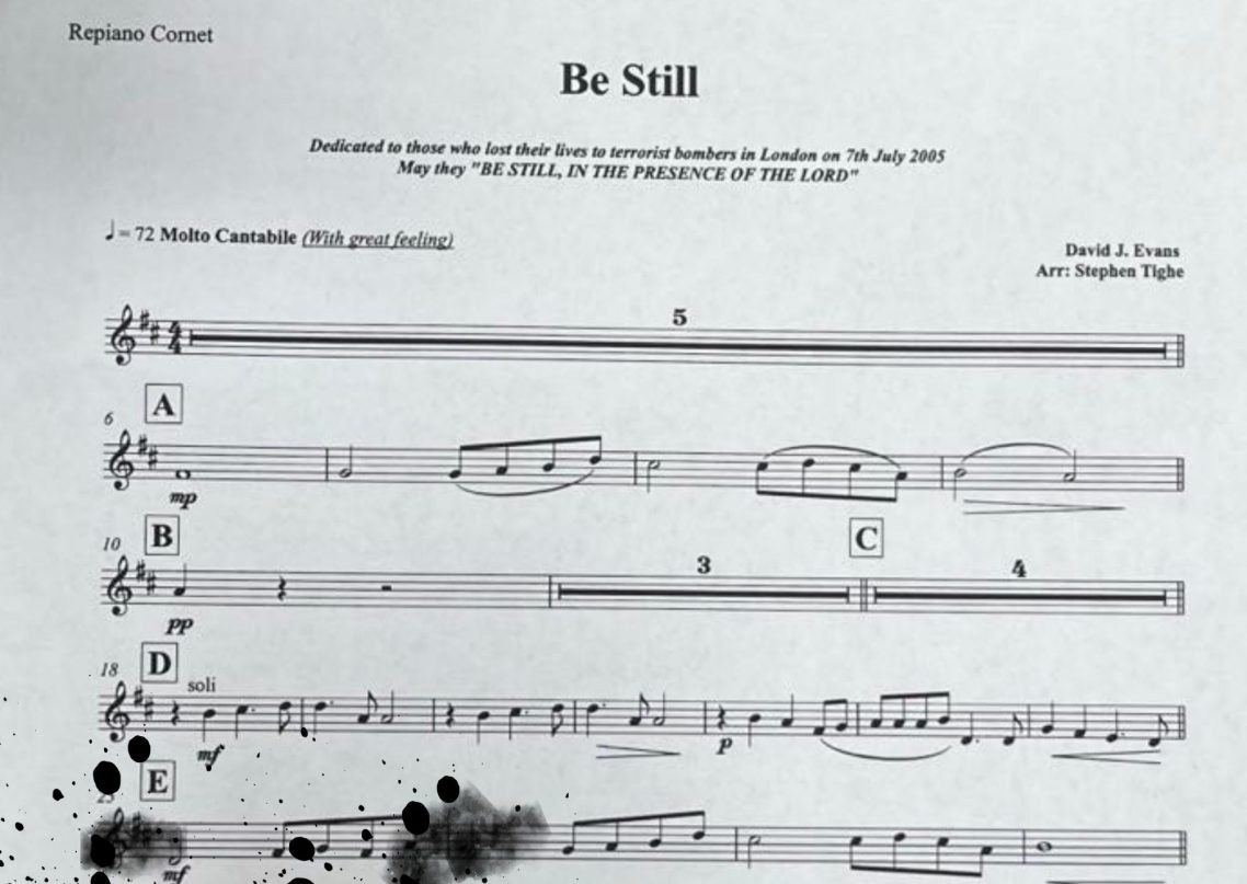 How Diane now sees her sheet music, the yoke prism moves the image to a less damaged area of her retina.