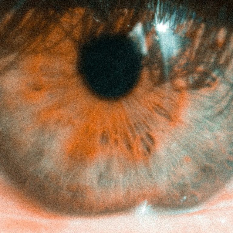 Sore Eye
